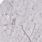 Immunohistochemical staining of human skeletal muscle shows no positivity in myocytes as expected.