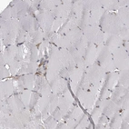 Immunohistochemical staining of human skeletal muscle shows no positivity in myocytes as expected.