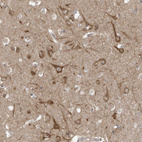 Anti-USE1 Antibody