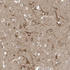Anti-USE1 Antibody
