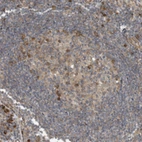 Immunohistochemical staining of human lymphoid node shows moderate cytoplasmic positivity in germinal center cells.