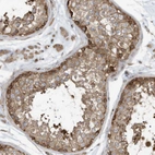 Immunohistochemical staining of human testis shows strong cytoplasmic positivity in cells in seminiferous ducts.
