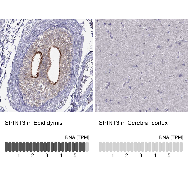 Anti-SPINT3 Antibody