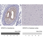 Anti-SPINT3 Antibody
