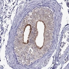 Immunohistochemical staining of human epididymis shows high expression.