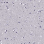 Immunohistochemical staining of human cerebral cortex shows low expression as expected.