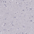 Immunohistochemical staining of human cerebral cortex shows low expression as expected.