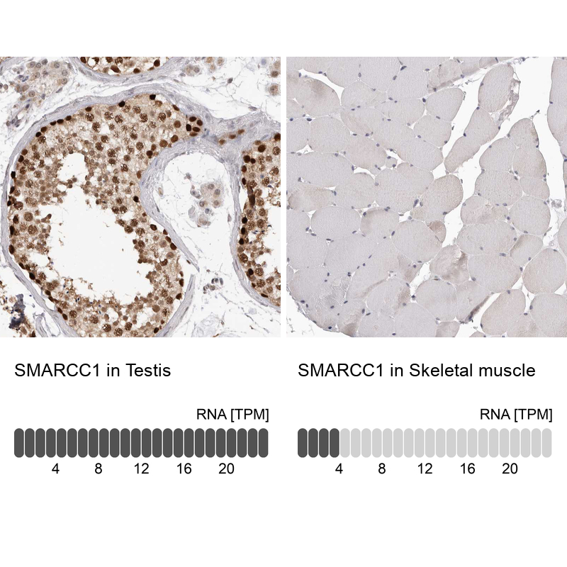 Anti-SMARCC1 Antibody