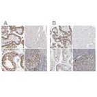 Immunohistochemical staining of human placenta, skeletal muscle, testis and tonsil using Anti-SMARCC1 antibody HPA026853 (A) shows similar protein distribution across tissues to independent antibody HPA024352 (B).
