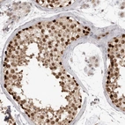 Immunohistochemical staining of human testis shows strong nuclear positivity in cells in seminiferous ducts.