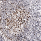 Immunohistochemical staining of human tonsil shows strong nuclear positivity in germinal center cells.