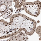 Immunohistochemical staining of human placenta shows strong nuclear positivity in trophoblastic cells.