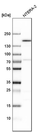 Western blot analysis in human cell line NTERA-2.