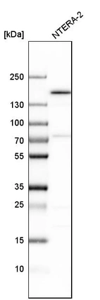 Western blot analysis in human cell line NTERA-2.