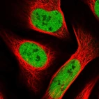 Immunofluorescent staining of human cell line U-2 OS shows localization to nucleoplasm.