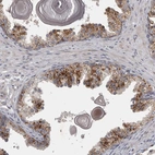 Immunohistochemical staining of human prostate shows strong cytoplasmic granular positivity in glandular cells.
