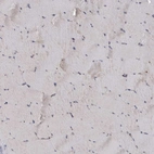 Immunohistochemical staining of human skeletal muscle shows no cytoplasmic granular positivity in myocytes as expected.