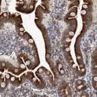 Immunohistochemical staining of human duodenum shows strong cytoplasmic positivity in glandular cells.