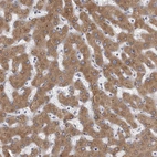 Immunohistochemical staining of human liver shows strong cytoplasmic positivity in hepatocytes.