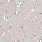 Immunohistochemical staining of human skeletal muscle shows no positivity in myocytes as expected.