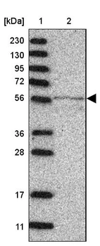 Lane 1: Marker [kDa] 230, 130, 95, 72, 56, 36, 28, 17, 11_br/_Lane 2: Human cell line RT-4