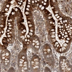 Anti-CCPG1 Antibody
