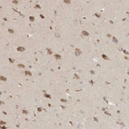 Immunohistochemical staining of human cortex shows moderate cytoplasmic positivity in neurons.