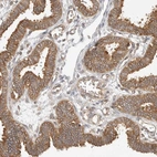 Immunohistochemical staining of human fallopian tube shows moderate cytoplasmic positivity in glandular cells.