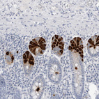 Anti-ABHD12 Antibody