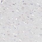 Immunohistochemical staining of human cerebral cortex shows weak cytoplasmic positivity in neurons.