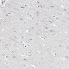 Immunohistochemical staining of human cerebral cortex shows weak cytoplasmic positivity in neurons.
