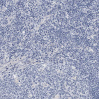 Immunohistochemical staining of human tonsil shows no cytoplasmic positivity in non-germinal center cells as expected.