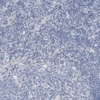 Immunohistochemical staining of human tonsil shows no cytoplasmic positivity in non-germinal center cells as expected.
