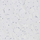 Immunohistochemical staining of human skeletal muscle shows no cytoplasmic positivity in myocytes as expected.