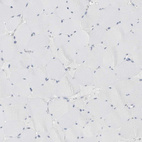 Anti-ABHD12 Antibody