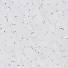 Immunohistochemical staining of human skeletal muscle shows no cytoplasmic positivity in myocytes as expected.
