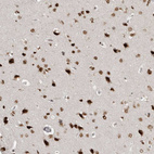 Immunohistochemical staining of human cerebral cortex shows strong nuclear positivity in neuronal cells.