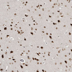 Anti-YAF2 Antibody