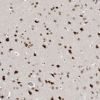Immunohistochemical staining of human cerebral cortex shows strong nuclear positivity in neuronal cells.