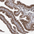 Immunohistochemical staining of human fallopian tube shows strong nuclear positivity in glandular cells.