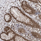 Immunohistochemical staining of human colon shows strong nuclear positivity in glandular cells.