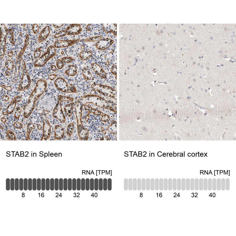 Anti-STAB2 Antibody