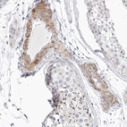 Immunohistochemical staining of human testis shows moderate cytoplasmic positivity in endothelial cells.