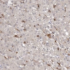 Immunohistochemical staining of human liver shows moderate to strong cytoplasmic positivity in hepatic sinusoid cells.
