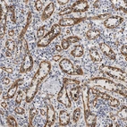 Immunohistochemical staining of human spleen shows strong cytoplasmic positivity in endothelial cells.