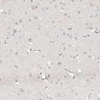 Immunohistochemical staining of human cerebral cortex shows low expression as expected.