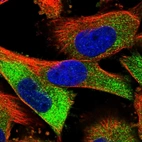 Immunofluorescent staining of human cell line U-251 MG shows localization to cytosol.