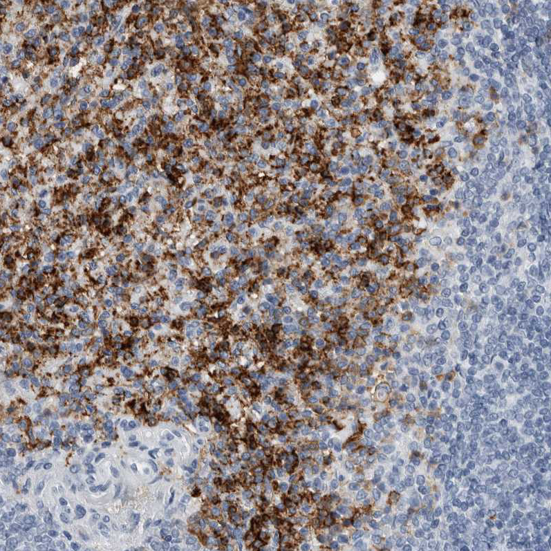 Anti-FCER1G Antibody