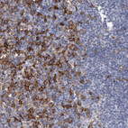 Anti-FCER1G Antibody