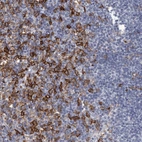 Immunohistochemical staining of human lymph node shows strong membranous positivity in non-germinal center cells.